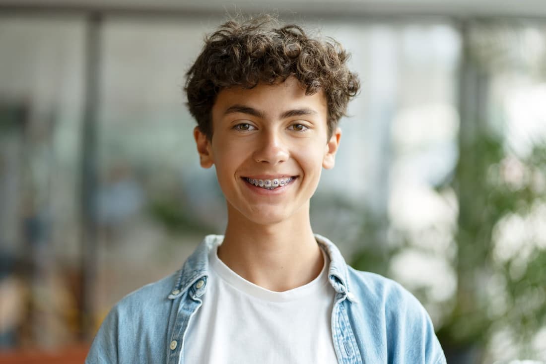 6-Month Smiles Orthodontics