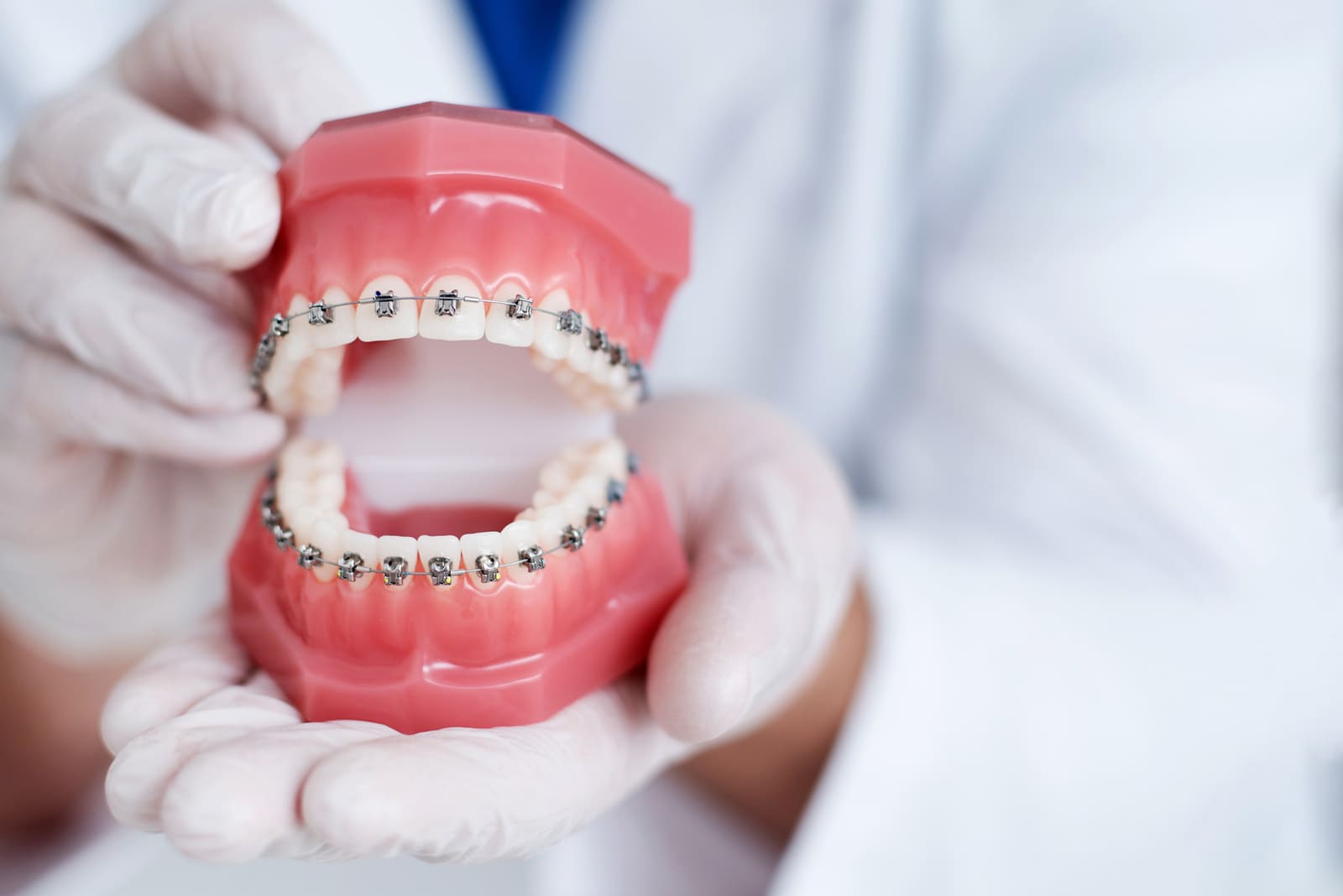 Close-up of traditional braces on teeth at Braswell Family Dentistry in Perry, GA