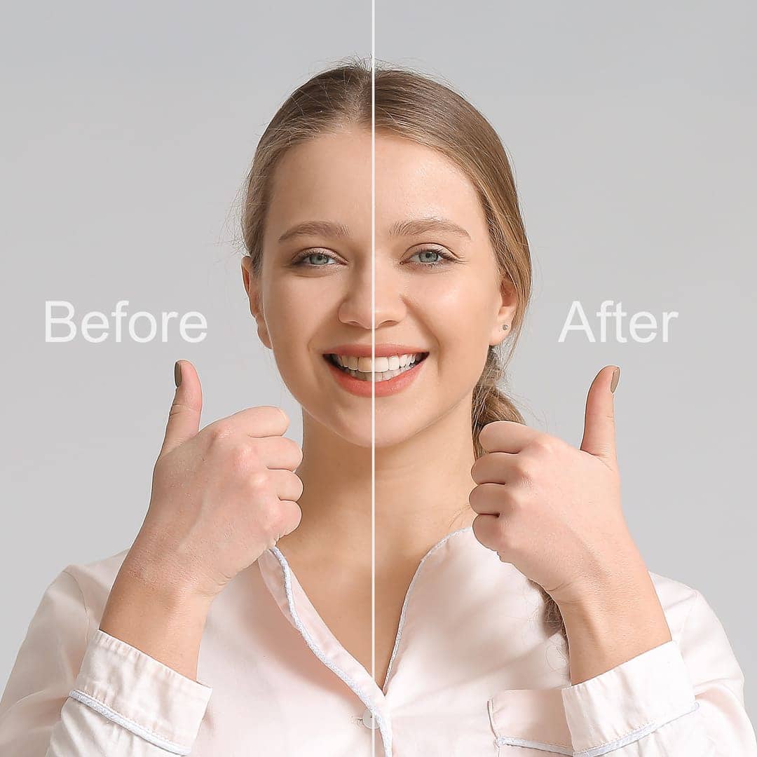 Before and after smile makeover results at Braswell Family Dentistry in Perry, GA
