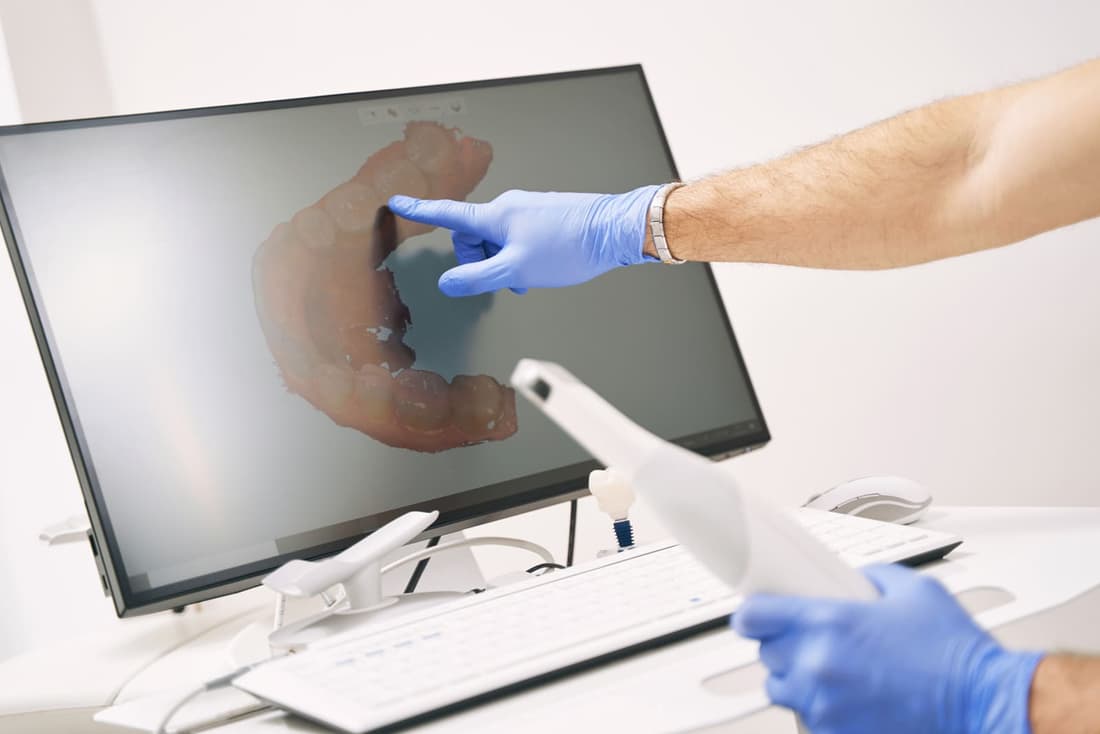 3-Shape digital scanner at Braswell Family Dentistry in Perry, GA