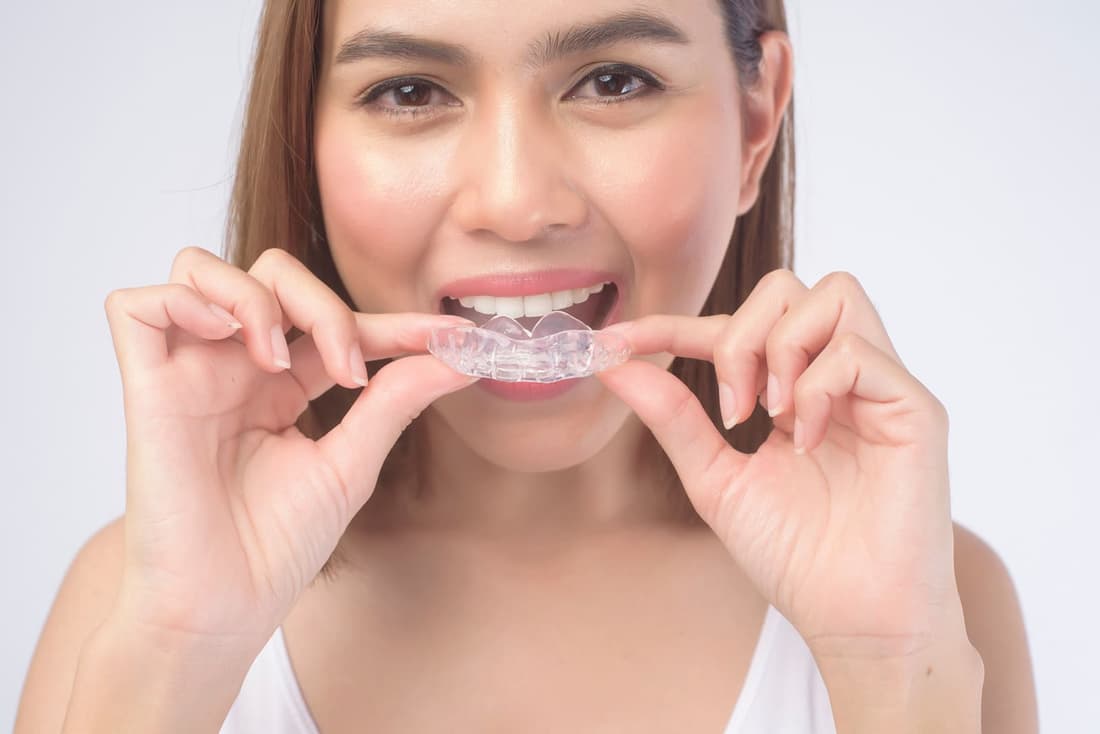 Custom occlusal and sports mouthguards at Braswell Family Dentistry in Perry, GA